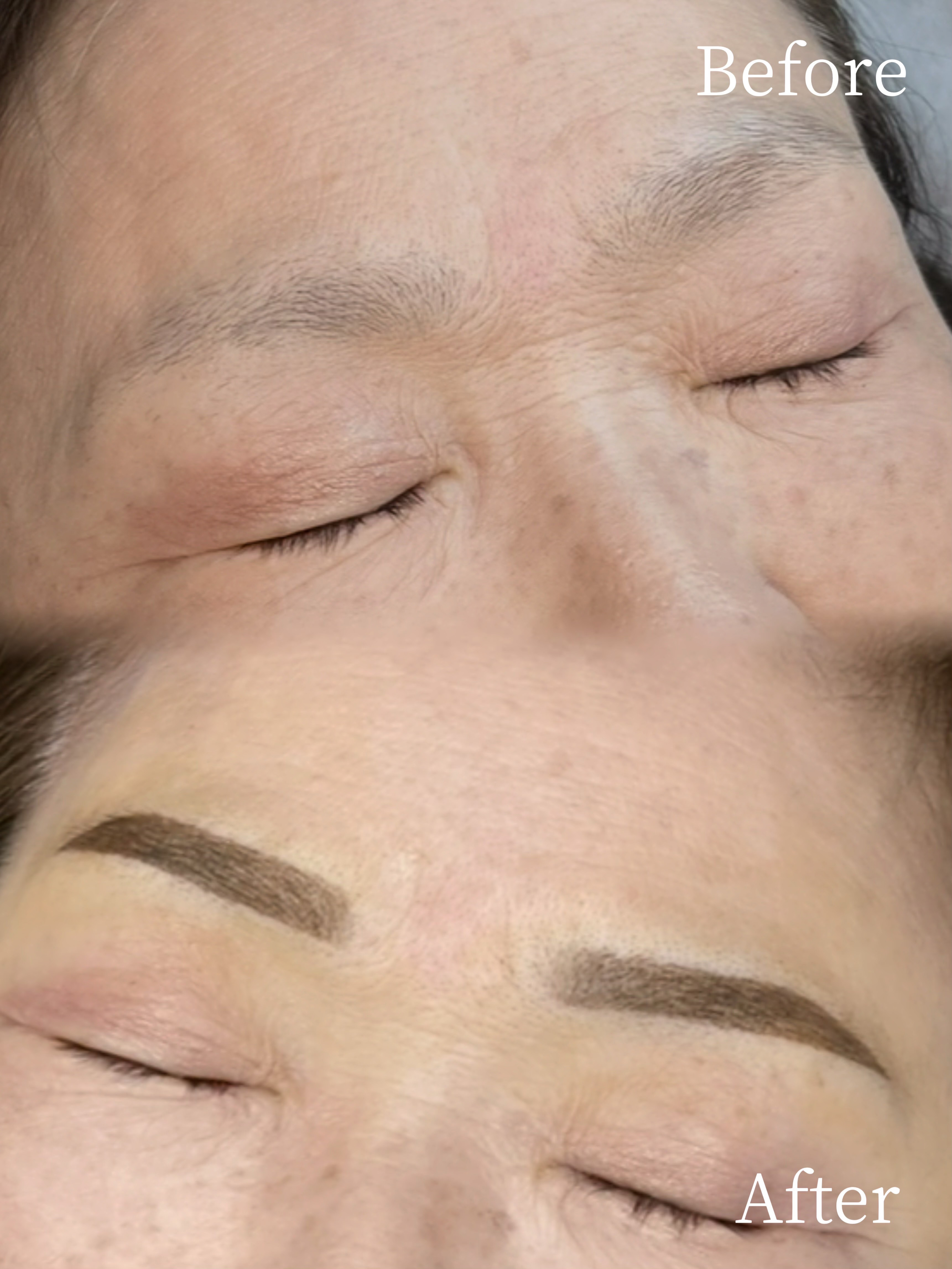 リーズプライベートクリニック｜眉アートメイクの症例